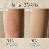 Before and after: calmer, less irritated forearm skin in 2 weeks
