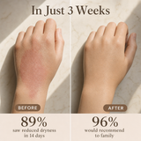 Before and after: back-of-hand less dry and red in 3 weeks