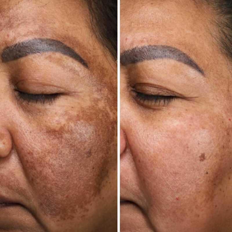 <p>Real Sisters, Real Results</p>